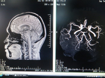 MRI画像 001.JPG
